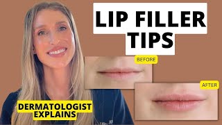 Dermatologist Shares 9 Lip Filler Tips to Know Before and After Treatment [upl. by Arret635]