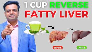 DRINK 1 Cup Per Day To Reverse Fatty Liver [upl. by Skier713]