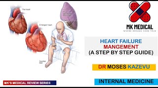 Heart failure Management [upl. by Nahtanod419]