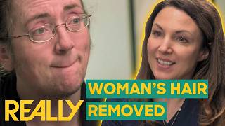 Facial Hair Stops Woman From Dating  The Bad Skin Clinic [upl. by Neufer63]