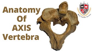 Axis Vertebra Anatomy 2nd Cervical VertebraHuman Osteology [upl. by Enirolf]