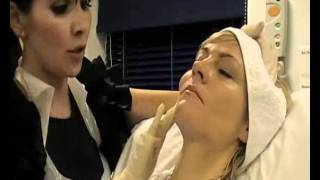 Skin Rejuvenation  Sculptra Treatment live demonstration  female patient [upl. by Yendirb451]