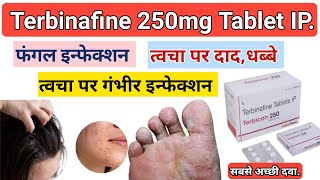 Terbinafine Tablet Use In HindiSide EffectsPrecautions [upl. by Moclam656]