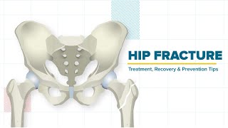 Hip Fracture  Treatment Recovery amp Prevention Tips [upl. by Hemphill210]