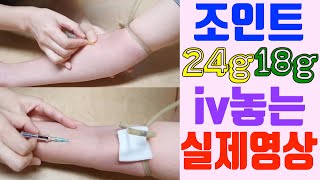 실패없는 조인트 18g iv 24g iv 완전 마스터 하세요  조인트iv 실패없이 한번에 성공하는 특급비밀 [upl. by Brigham941]