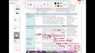 Adenocarcinoma Respiratory 54  First Aid USMLE Step 1 in UrduHindi [upl. by Ecirad]