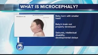 What is microcephaly [upl. by Noterb935]