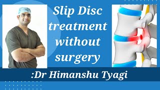 Non Surgical Treatment of Slip Disc [upl. by Atnaloj]