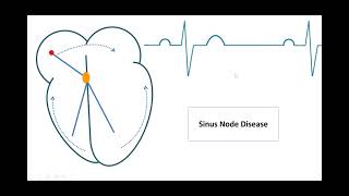 ECG amp Arrhythmia Interpretation Part 01 [upl. by Wit]