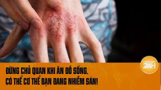 Đừng chủ quan khi ăn đồ sống có thể cơ thể bạn đang nhiễm sán  Toàn cảnh 24h [upl. by Stuppy116]