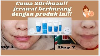 Review Wardah Acnederm Series pemakaian 7 HARI [upl. by Jahncke]