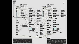 Karplus Strong Experiment in MaxMSP [upl. by Ganny]