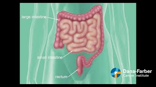 Colon v Rectal Cancer What you need to know [upl. by Scriven]