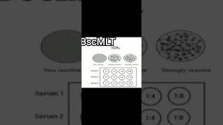 VDRL TEST  TREPONEMA PALLIDUM  MICROBIOLOGY  BMLT  BscMLT [upl. by Lauralee]