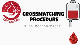 Crossmatching Procedure  Tube methodMajor [upl. by Atirb]