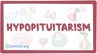 Hypopituitarism  causes symptoms diagnosis treatment pathology [upl. by Ydurt]