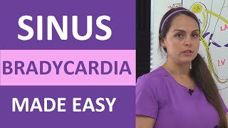 Sinus Bradycardia ECGEKG Interpretation Causes Treatment Nursing NCLEX Review Cardiac [upl. by Besse]