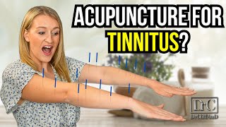 Acupuncture Treatment for Tinnitus [upl. by Esteban915]