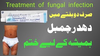 fungal infection in private parts Lamisil cream uses in urdu Terbinafine cream jock itch [upl. by Erine613]