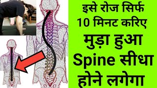 best stretches amp exercises for scoliosis S shape scoliosis exercises spine deformity physiotherapy [upl. by Cristiona600]