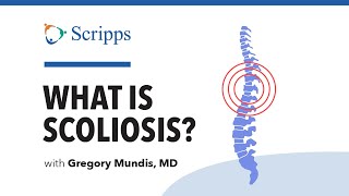 Scoliosis Symptoms and Treatment with Dr Gregory Mundis  San Diego Health [upl. by Cybill]