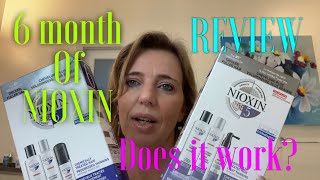 6 months of Nioxin review  hair treatment for fuller and thicker hair [upl. by Leler]