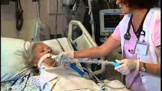 Tracheostomy Suctioning Free Nursing Video Lecture [upl. by Edsel]