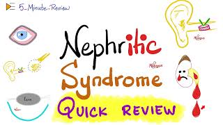 Nephritic Syndrome  APSGN RPGN IgAN Alport  Quick Review  5 Minute Review Series [upl. by Ydnih752]