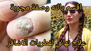 علاج طبيعي لفطريات الاظافر mycose des ongles بسرعة متنسايش دعي معايا بعد الوصفة [upl. by Porche]