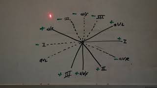 Electrocardiogram Leads Limb Leads Polarity [upl. by Sivar]