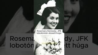 Rosemary Kennedy John F Kennedy lobotómián átesett húga [upl. by Astiram]