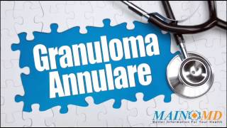 Granuloma Annulare ¦ Treatment and Symptoms [upl. by Clintock]