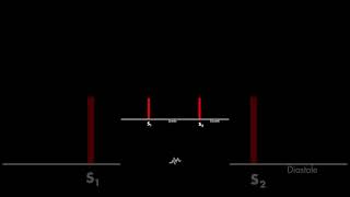 Normal Heart Sounds [upl. by Eveleen]