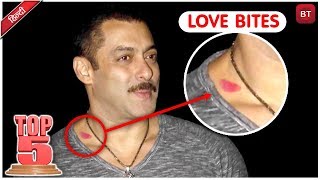 Bollywoods Top 5 Actors Who Flaunted Their Love Bites  Bollywood Actors Love Story [upl. by Nitaj]