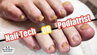 Nail Technician or Podiatrist A Comparison in Feet and Foot Care Approaches [upl. by Zigmund]