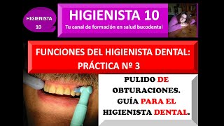 PULIDO DE OBTURACIONES GUÍA PARA EL HIGIENISTA DENTAL [upl. by Rebeka]