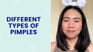 Different Types of Pimples  FaceTory [upl. by Honeyman861]