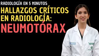 Radiología en 5 minutos Hallazgos críticos en Radiología  Neumotórax [upl. by Bayless]