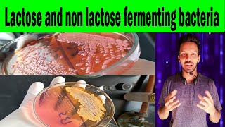 Lactose and non lactose fermenting bacteria  MacConkey agar Clear explanation [upl. by Hallee]