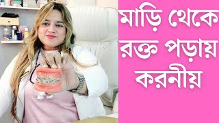 মাড়িথেকেরক্তপড়লেকরণীয়  ডাঃ জান্নাতুল ফেরদৌস বৃষ্টি  01749863658 [upl. by Chemesh]