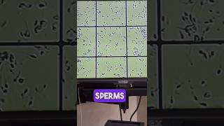 Identifying Sperm Motile vs Immotile Live Demonstration [upl. by Etteuqal760]