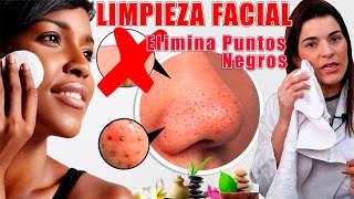 La Mejor LIMPIEZA FACIAL en Casa ¡Elimina los Puntos Negros y Deja la Piel Asombrosa [upl. by Carri]