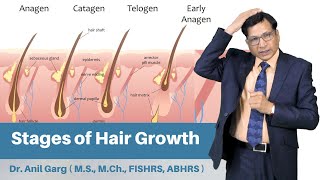 Stages of Hair Growth  How Do Hair Grow  Anagen Catagen Telogen Phase  Dr Anil Garg [upl. by Kushner]