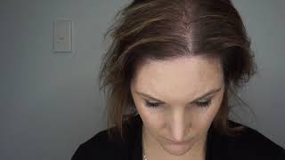 Alyssas Scalp MicroPigmentation Story  SMP for Women  Melissa Carr Cosmetic Tattooing [upl. by End45]