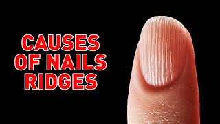 Causes of Ridged Nails and How to Avoid Them [upl. by Uno]