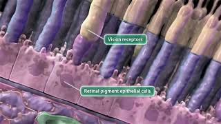 Audio Description Animation Leber Congenital Amaurosis [upl. by Ariahs]