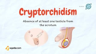 Cryptorchidism  Undescending Testicles  Causes Pathology  Pediatrics Video Lecture [upl. by Colby]