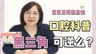 成人正畸后遗症 不良反应！出现黑三角该怎么办？牙龈萎缩真的不可逆么？ [upl. by Renraw12]