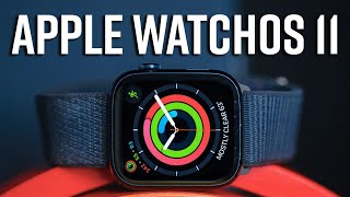 WatchOS 11 Best Features for Apple Watch [upl. by Liddle347]