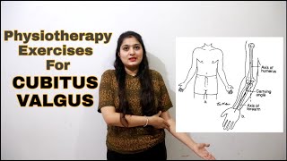 How to cure CUBITUS VALGUS  Carrying Angle Elbow क्या होता है  Cure Carrying Angle Elbow [upl. by Flynn]